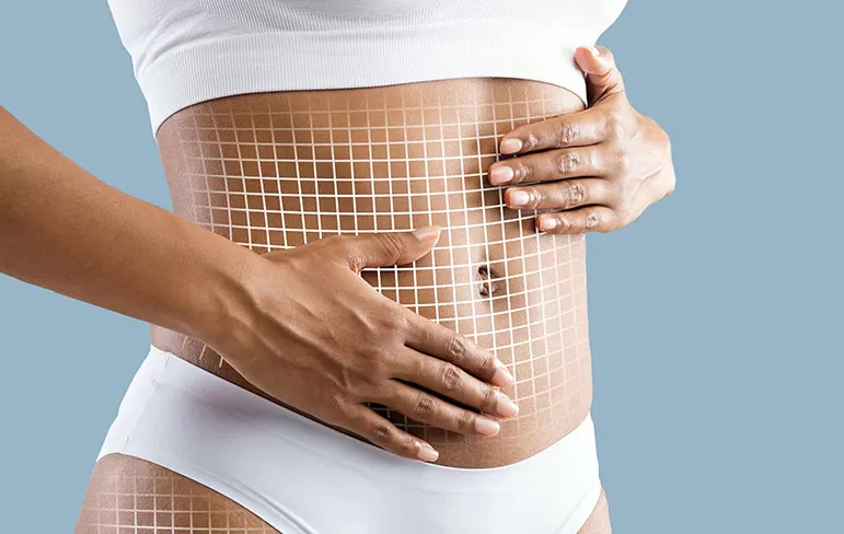 Magic Shape: Vücut Şekillendirmede Son Nokta