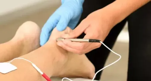 İğneli Epilasyon ile Kalıcı Çözüm: Nasıl Çalışır?