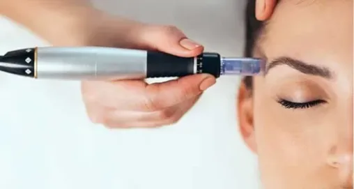 Dermapen Uygulamasının Etkileri: Gerçekten Etkili mi?