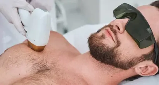 Erkek Epilasyonunda Dikkat Edilmesi Gerekenler