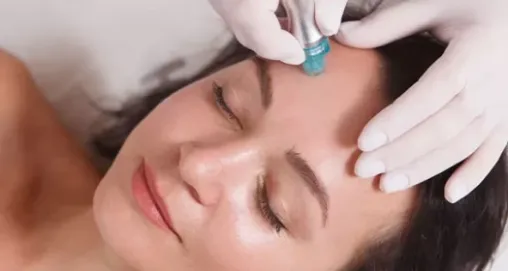 Hydrafacial: Cildinizi Yenileyen Sihirli Dokunuş