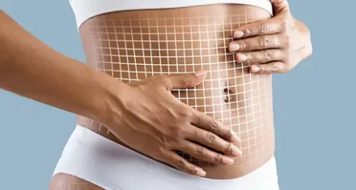 Magic Shape: Vücut Şekillendirmede Son Nokta